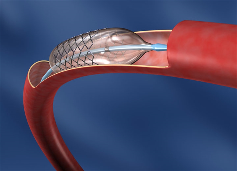 의료기기 제조시 가습 및 습기 제어